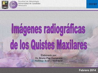 Elaborado por:
Dr. Bruno Pier Doménico
Radiólogo Bucal y Maxilofacial
Febrero 2014
 
