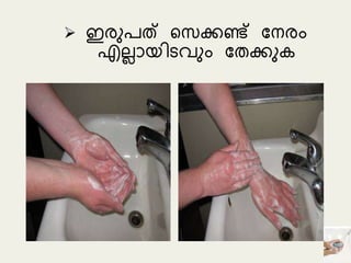  ഇരുപത് ട കണ്ട് മനരും
എല്ലോയിെവുും മതകുക
 