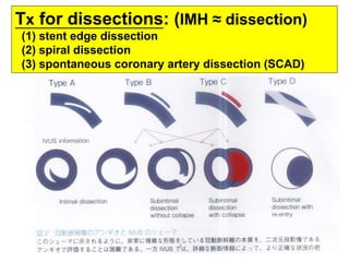 Edge Dissection How to manage coronary dissections and intramural hematomas 2015 | PPTX