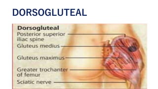 DORSOGLUTEAL
 