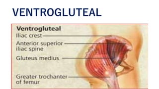 VENTROGLUTEAL
 