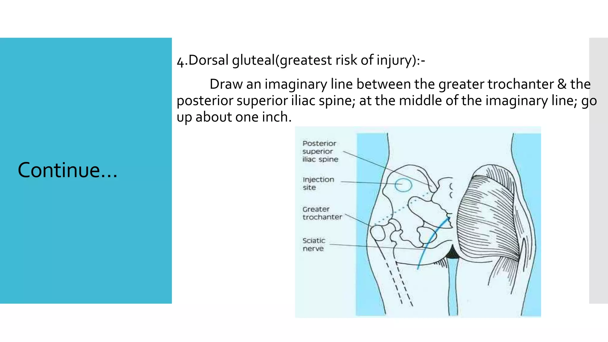 Continue…
4.Dorsal gluteal(greatest risk of injury):-
Draw an imaginary line between the greater trochanter & the
posterior superior iliac spine; at the middle of the imaginary line; go
up about one inch.
 
