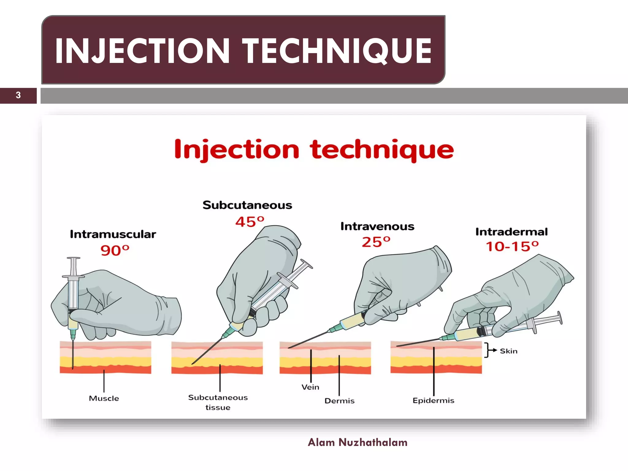 Alam Nuzhathalam
3
INJECTION TECHNIQUE
 