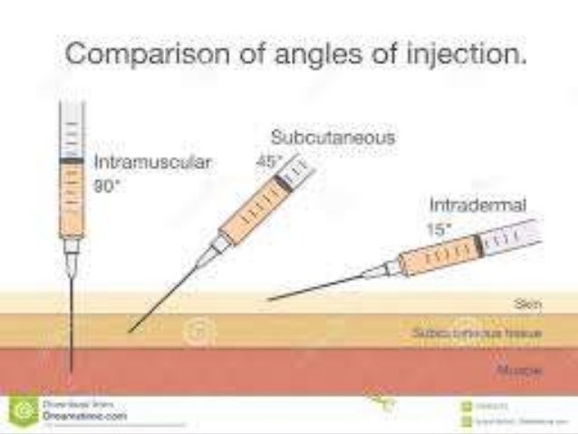 INTRAMUSCULAR INJECTIONS