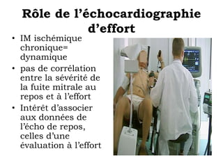 Rôle de l’échocardiographie 
d’effort 
• IM ischémique 
chronique= 
dynamique 
• pas de corrélation 
entre la sévérité de 
la fuite mitrale au 
repos et à l’effort 
• Intérêt d’associer 
aux données de 
l’écho de repos, 
celles d’une 
évaluation à l’effort 
 