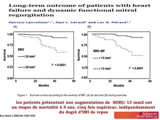 Figure 1 Survival curves according to the severity of MR. (A) at rest and (B) during exercise 
Eur Heart J 2005;26:1528-1532 
 