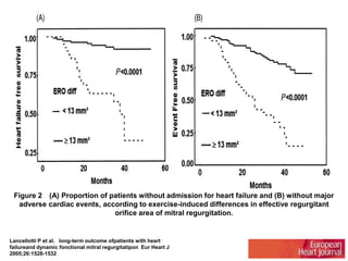 Figure 2 (A) Proportion of patients without admission for heart failure and (B) without major 
adverse cardiac events, according to exercise-induced differences in effective regurgitant 
orifice area of mitral regurgitation. 
Lancellotti P et al. long-term outcome ofpatients with heart 
failureand dynamic fonctional mitral regurgitatipon Eur Heart J 
2005;26:1528-1532 
 