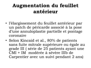 Augmentation du feuillet 
antérieur 
• l’élargissement du feuillet antérieur par 
un patch de péricarde associé à la pose 
d’une annuloplastie partielle et pontage 
coronaire 
• Selon Kincaid et al., 80% de patients 
sans fuite mitrale supérieure ou égale au 
grade III ( série de 25 patients ayant une 
CMI + IM modérée à sévère IIIb de 
Carpentier avec un suivi pendant 2 ans) 
 