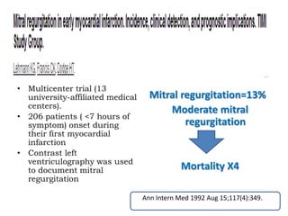 • Multicenter trial (13 
university-affiliated medical 
centers). 
• 206 patients ( <7 hours of 
symptom) onset during 
their first myocardial 
infarction 
• Contrast left 
ventriculography was used 
to document mitral 
regurgitation 
Mitral regurgitation=13% 
Moderate mitral 
regurgitation 
Mortality X4 
Ann Intern Med 1992 Aug 15;117(4):349. 
 