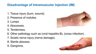 Disadvantage of Intramuscular Injection (IM)
1. Tissue injury (burn, wound).
2. Presence of nodules.
3. Lumps.
4. Abscesses.
5. Tenderness.
6. Other pathology such as (viral hepatitis B), (cross infection) .
7. Sciatic nerve injury (nerve damage).
8. Sterile abscess.
9. Gangrene.
 