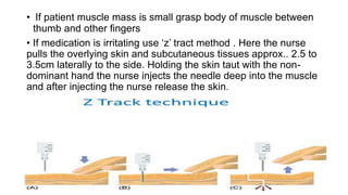 • If patient muscle mass is small grasp body of muscle between
thumb and other fingers
• If medication is irritating use ‘z’ tract method . Here the nurse
pulls the overlying skin and subcutaneous tissues approx.. 2.5 to
3.5cm laterally to the side. Holding the skin taut with the non-
dominant hand the nurse injects the needle deep into the muscle
and after injecting the nurse release the skin.
 