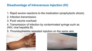 Disadvantage of Intravenous Injection (IV)
1. Rapid severe reactions to the medication (anaphylactic shock).
2. Infection transmission.
3. Fluid volume overload.
4. Transmission of infection by contaminated syringe such as
(HIV, viral hepatitis B).
5. Thrombophlebitis repeated injection on the same vein.
 