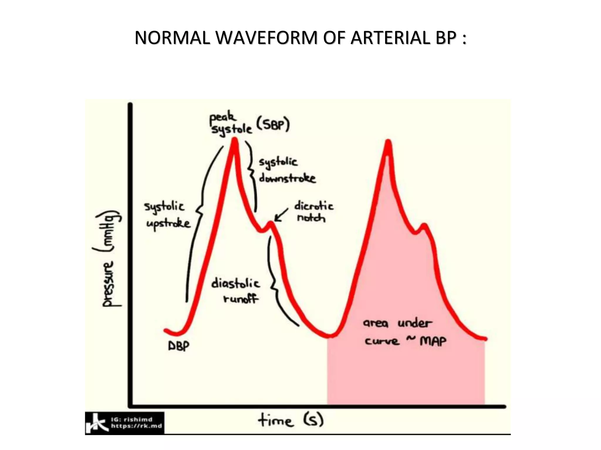 NORMAL WAVEFORM OF ARTERIAL BP :
 