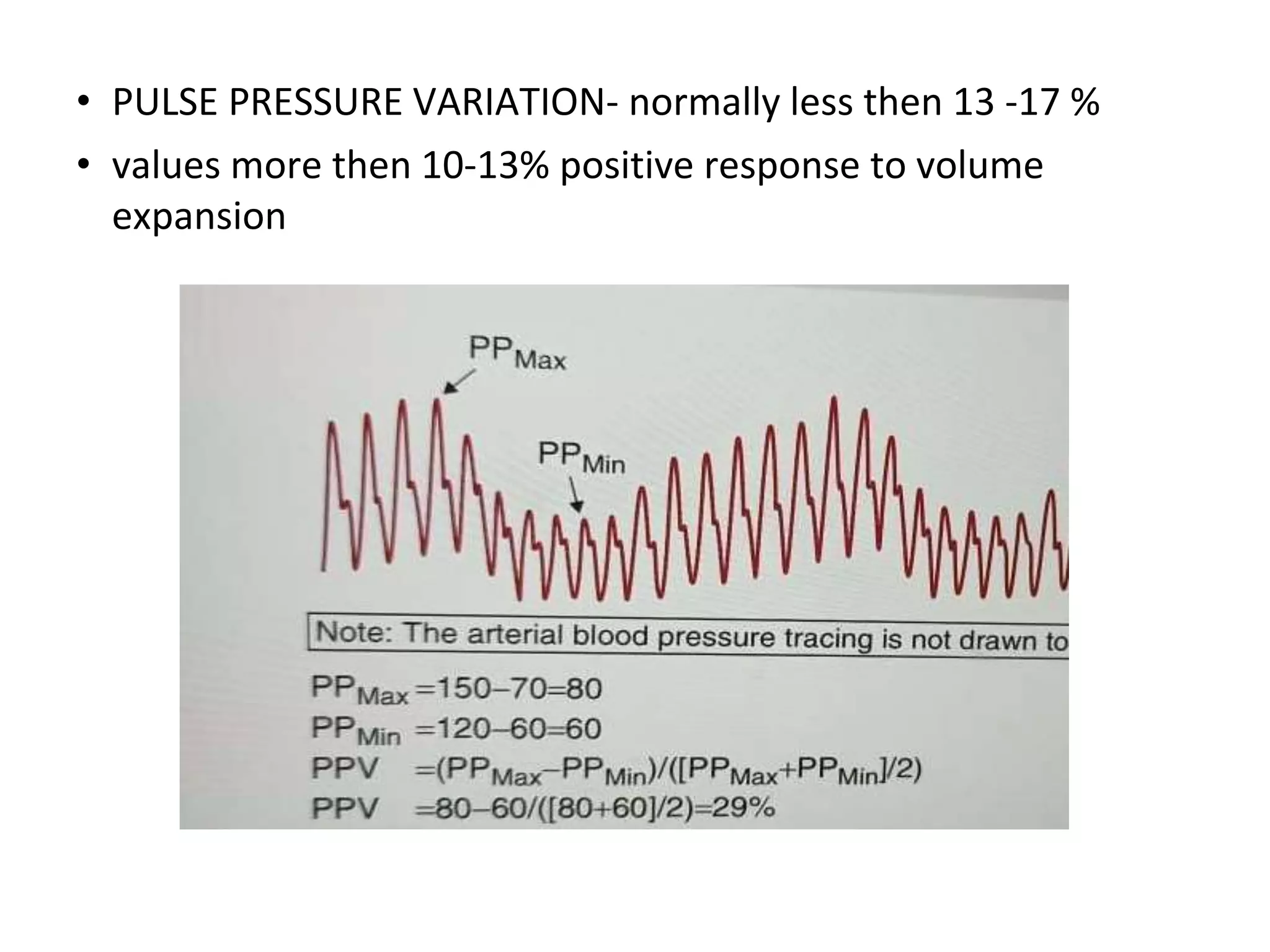 • PULSE PRESSURE VARIATION- normally less then 13 -17 %
• values more then 10-13% positive response to volume
expansion
 
