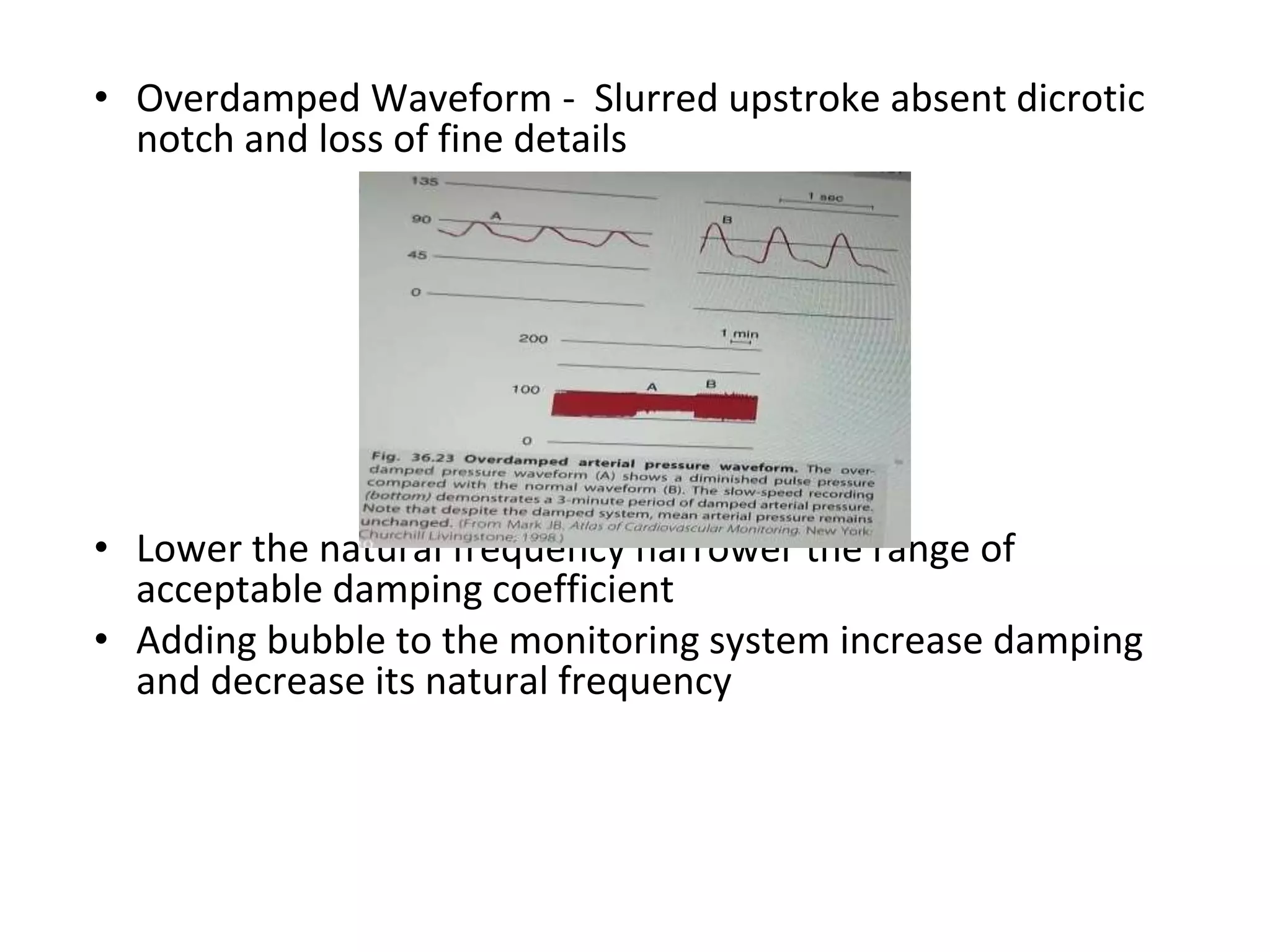 • Overdamped Waveform - Slurred upstroke absent dicrotic
notch and loss of fine details
• Lower the natural frequency narrower the range of
acceptable damping coefficient
• Adding bubble to the monitoring system increase damping
and decrease its natural frequency
 