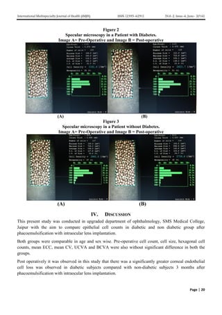 Normal Cell Count Eye Comparison of Corneal Endothelial Cell Counts in Patients with ...