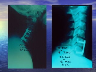 Η άμεση αντιμετώπιση του πολυκαταγματία - πολυτραυματία