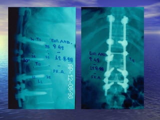Η άμεση αντιμετώπιση του πολυκαταγματία - πολυτραυματία