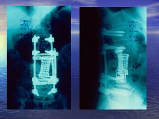 Η άμεση αντιμετώπιση του πολυκαταγματία - πολυτραυματία