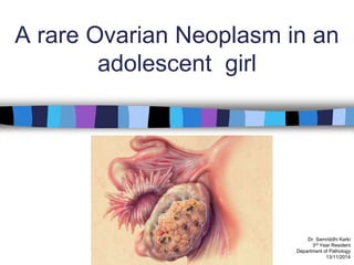 A rare Ovarian Neoplasm in an
adolescent girl
Dr. Samriddhi Karki
3rd Year Resident
Department of Pathology
13/11/2014
 