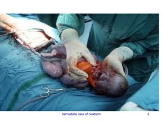 Immediate care of newborn   3
 
