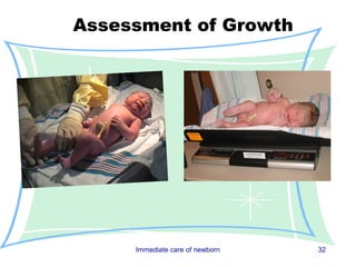 Assessment of Growth




     Immediate care of newborn   32
 