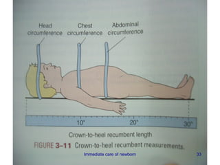Immediate care of newborn   33
 