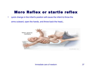 Moro Reflex or startle reflex
•   quick change in the infant's position will cause the infant to throw the

    arms outward, open the hands, and throw back the head      .




                               Immediate care of newborn                       37
 