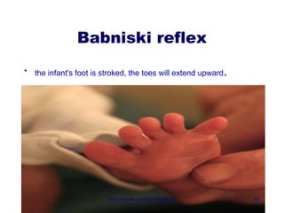 Babniski reflex
•   the infant's foot is stroked, the toes will extend upward   .




                          Immediate care of newborn                 40
 
