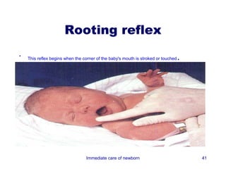 Rooting reflex
•
    This reflex begins when the corner of the baby's mouth is stroked or touched   .




                                 Immediate care of newborn                             41
 