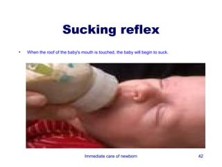 Sucking reflex
•   When the roof of the baby's mouth is touched, the baby will begin to suck.




                                  Immediate care of newborn                      42
 