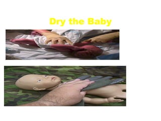 Dry the Baby
   • Hypothermia is common
   • Wet newborns rapidly lose
     heat
   • Use a warm, dry, soft towel
   • Any absorbent material:
 