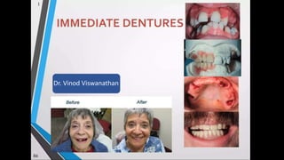 Photo Album
by vinod v
Dr. Vinod Viswanathan
 