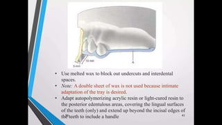 Immediate complete denture 05032023.pptx