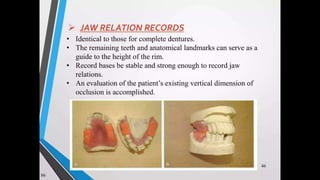Immediate complete denture 05032023.pptx