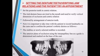 Immediate complete denture 05032023.pptx
