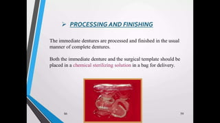 Immediate complete denture 05032023.pptx