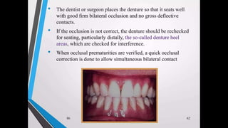 Immediate complete denture 05032023.pptx