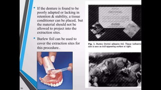 Immediate complete denture 05032023.pptx