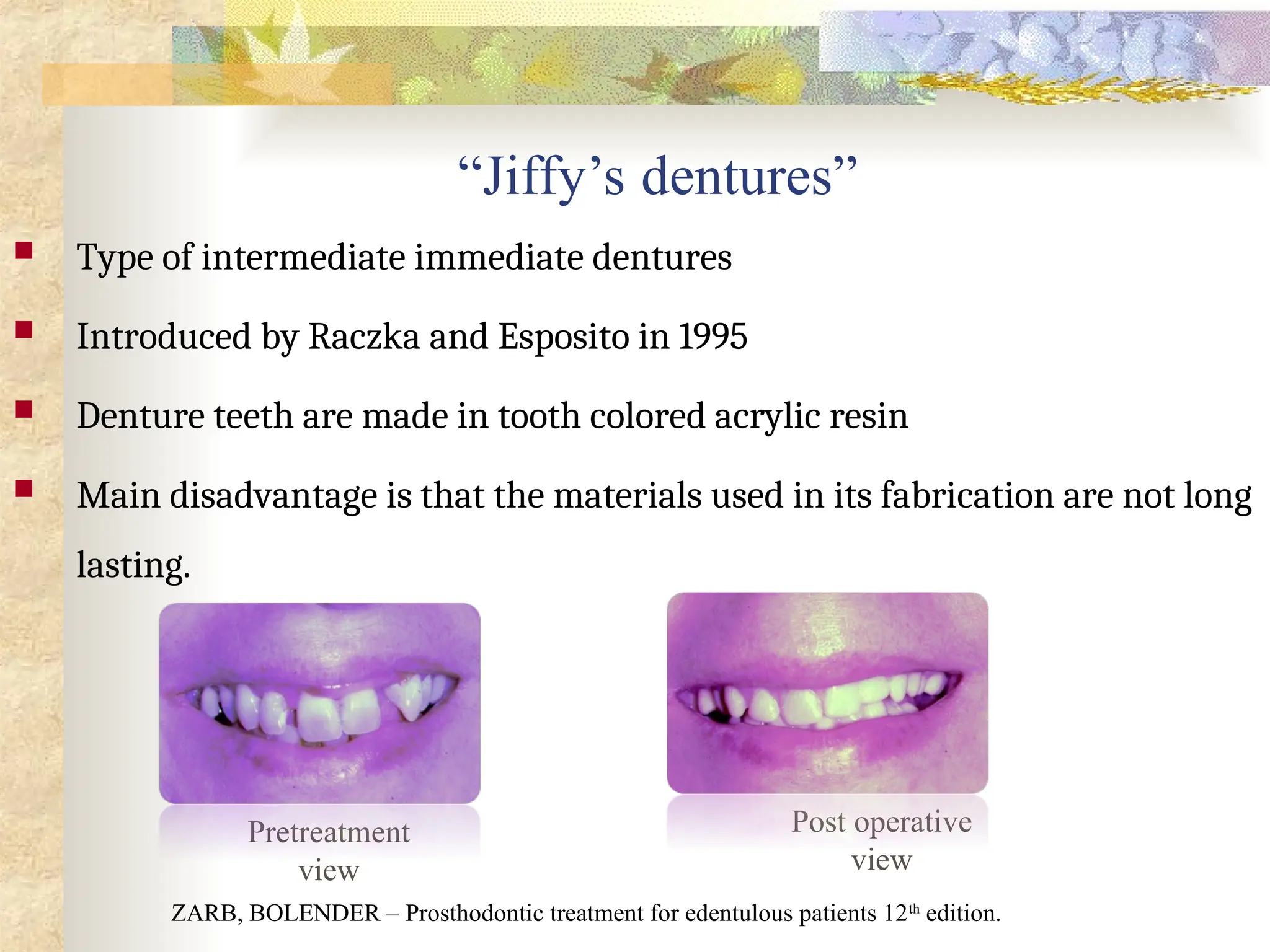 “Jiffy’s dentures”
 Type of intermediate immediate dentures
 Introduced by Raczka and Esposito in 1995
 Denture teeth are made in tooth colored acrylic resin
 Main disadvantage is that the materials used in its fabrication are not long
lasting.
ZARB, BOLENDER – Prosthodontic treatment for edentulous patients 12th
edition.
Post operative
view
Pretreatment
view
 