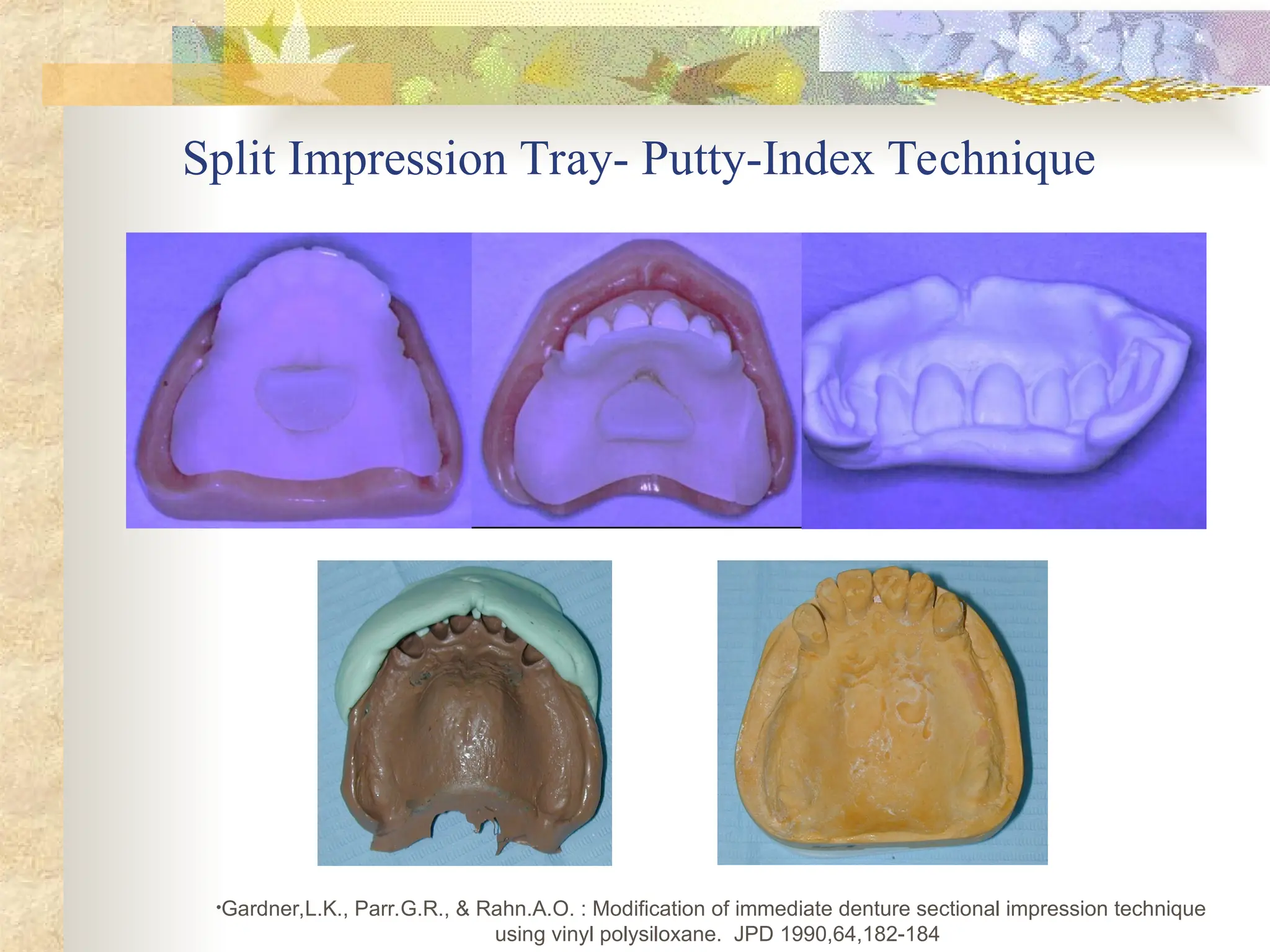 Split Impression Tray- Putty-Index Technique
•Gardner,L.K., Parr.G.R., & Rahn.A.O. : Modification of immediate denture sectional impression technique
using vinyl polysiloxane. JPD 1990,64,182-184
 