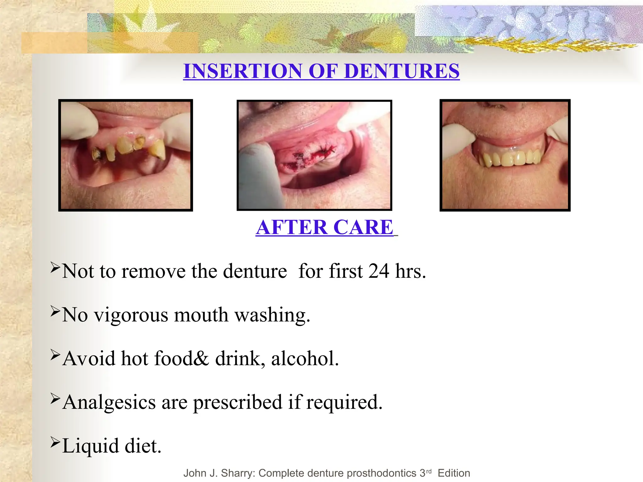 INSERTION OF DENTURES
John J. Sharry: Complete denture prosthodontics 3rd
Edition
AFTER CARE
Not to remove the denture for first 24 hrs.
No vigorous mouth washing.
Avoid hot food& drink, alcohol.
Analgesics are prescribed if required.
Liquid diet.
 