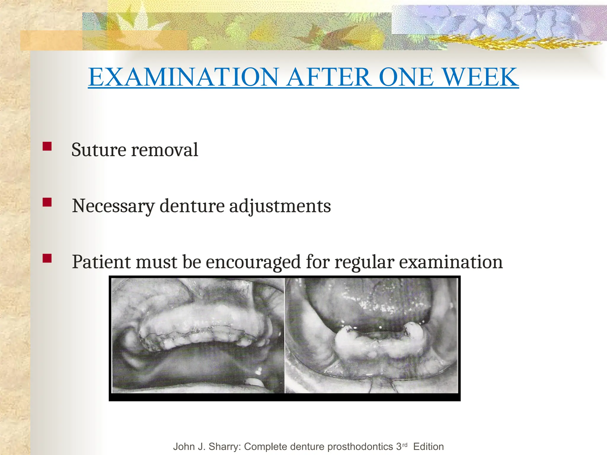 EXAMINATION AFTER ONE WEEK
 Suture removal
 Necessary denture adjustments
 Patient must be encouraged for regular examination
John J. Sharry: Complete denture prosthodontics 3rd
Edition
 