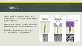 ImmediateDentinSealing.pptx