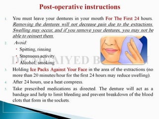 Immediate denture