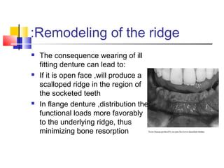 Remodeling of the ridge:
 The consequence wearing of ill
fitting denture can lead to:
 If it is open face ,will produce a
scalloped ridge in the region of
the socketed teeth
 In flange denture ,distribution the
functional loads more favorably
to the underlying ridge, thus
minimizing bone resorption
 
