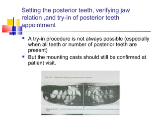 Setting the posterior teeth, verifying jaw
relation ,and try-in of posterior teeth
appointment
 A try-in procedure is not always possible (especially
when all teeth or number of posterior teeth are
present)
 But the mounting casts should still be confirmed at
patient visit.
 