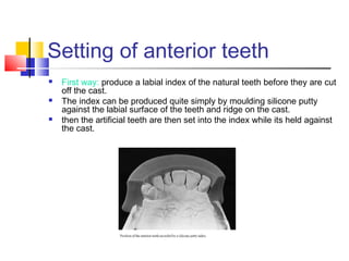Setting of anterior teeth
 First way: produce a labial index of the natural teeth before they are cut
off the cast.
 The index can be produced quite simply by moulding silicone putty
against the labial surface of the teeth and ridge on the cast.
 then the artificial teeth are then set into the index while its held against
the cast.
 