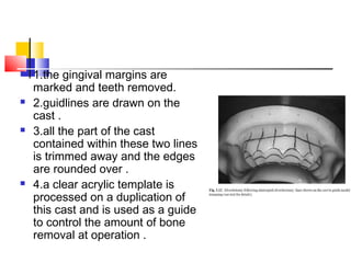  1.the gingival margins are
marked and teeth removed.
 2.guidlines are drawn on the
cast .
 3.all the part of the cast
contained within these two lines
is trimmed away and the edges
are rounded over .
 4.a clear acrylic template is
processed on a duplication of
this cast and is used as a guide
to control the amount of bone
removal at operation .
 