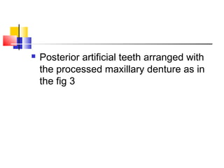  Posterior artificial teeth arranged with
the processed maxillary denture as in
the fig 3
 